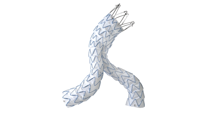 FDA Clears Medtronic’s Endurant Stent Graft to Drop rAAA Warning